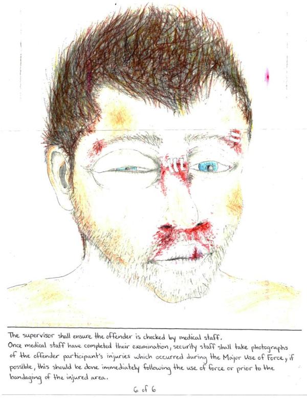 Prisoner Describes His Torture Through Art