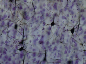 Prolonged isolation may damage the cerebral cortex, which is "the part of the brain that makes us most human."